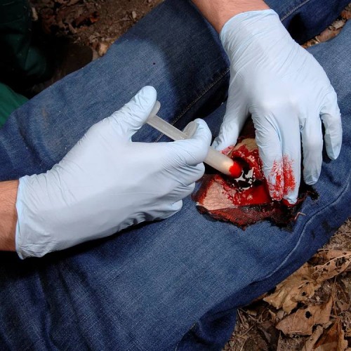 Аппликатор гемостатический с гранулами Rhino Rescue в Архангельске хитозановый
